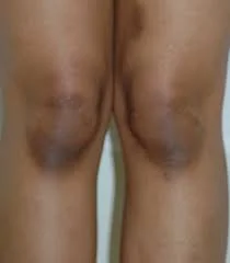 puresereluxcream image