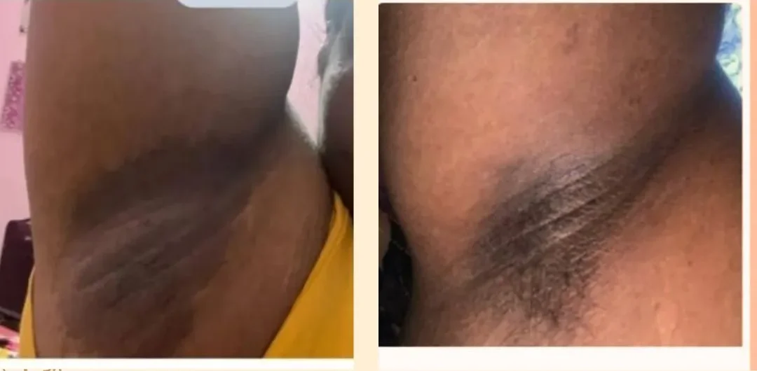 puresereluxcream image
