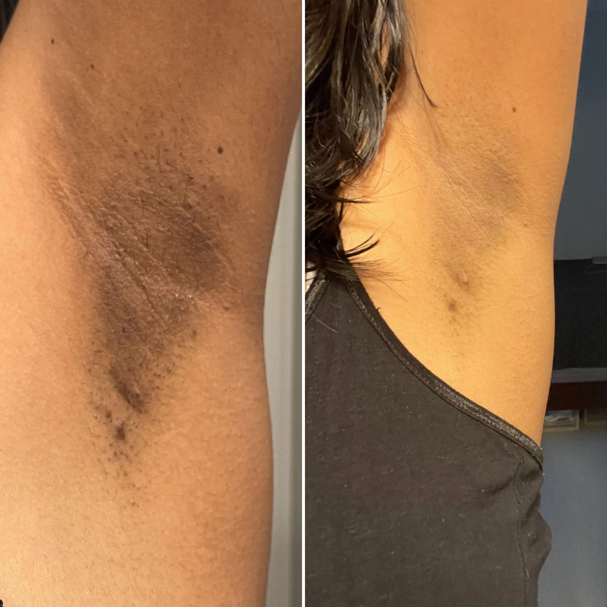 puresereluxcream image