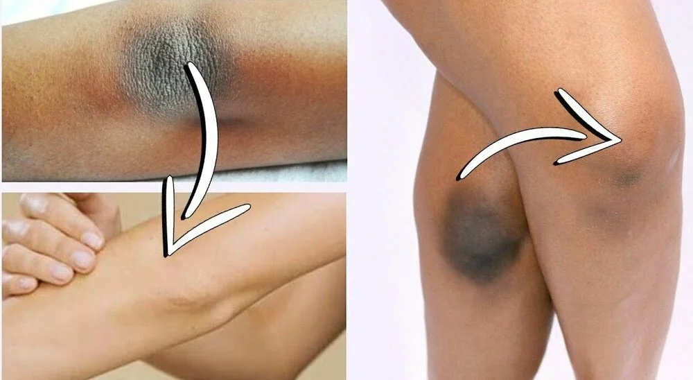 puresereluxcream image