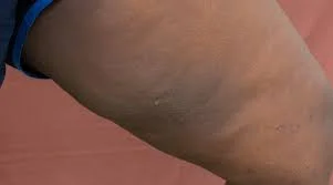 puresereluxcream image